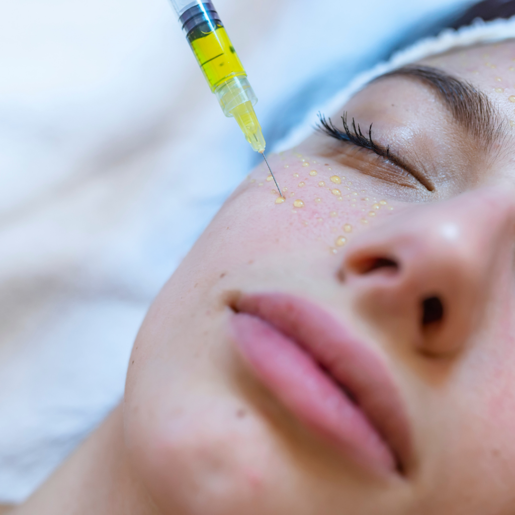 Injection de sérum dans la peau du visage